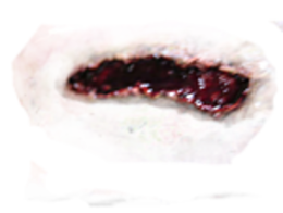 people & wounds free transparent png image.